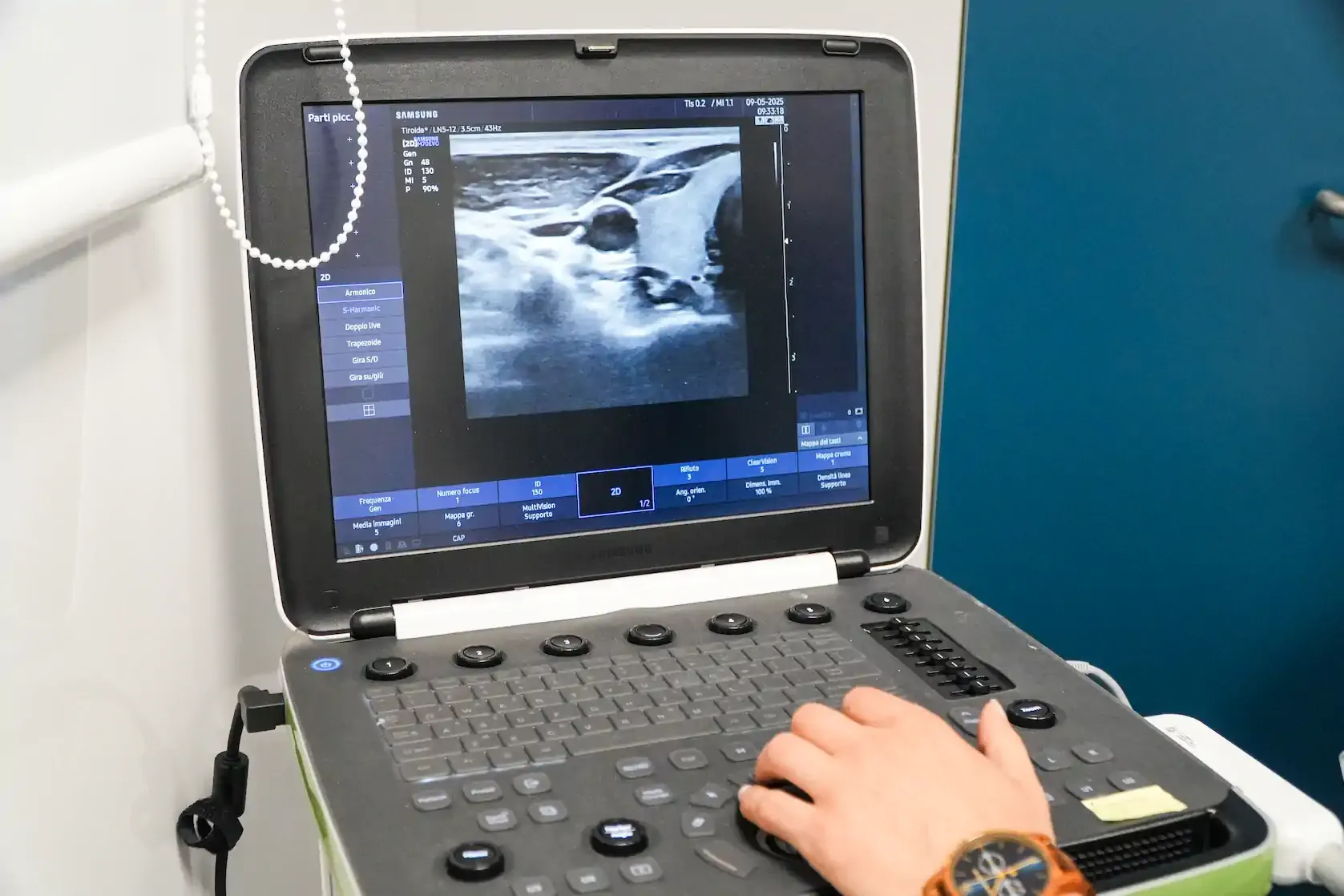 Screening Colon-Retto